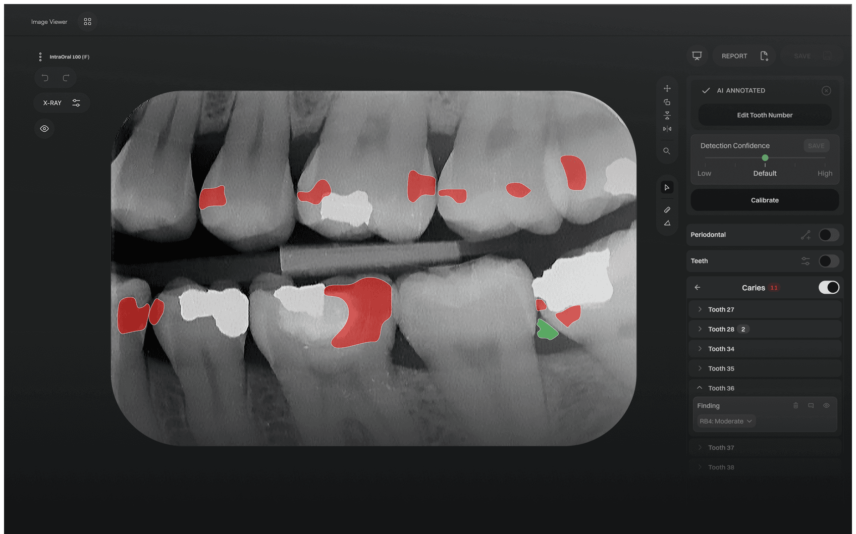 IntraOralFilm